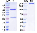 SDS-PAGE for Anti-BBS5 Antibody (N304B/99)