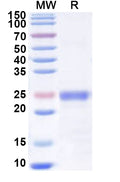 Recombinant Human PI16 Protein, N-His