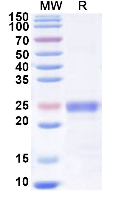 Recombinant Human PI16 Protein, N-His