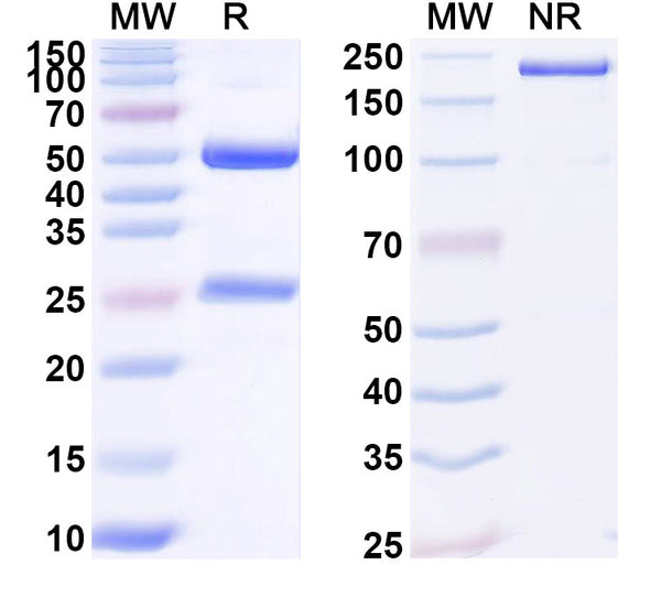 SDS-PAGE for Anti-Human CMKLR1 Antibody (SAA1892)