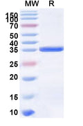 Recombinant Human EPGN Protein, N-GST & C-His