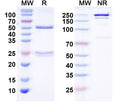 SDS-PAGE for Anti-Bral1 Antibody (N364/71)