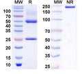 SDS-PAGE for Anti-BBS1 Antibody (N292/13)