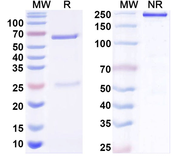 SDS-PAGE for Anti-BBS1 Antibody (N292/49)