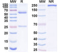 SDS-PAGE for Anti-Human CD175/Tn Antibody (83D4).