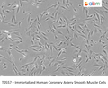 Immortalized Human Coronary Artery Smooth Muscle Cells | Applied Biological Materials (abm)