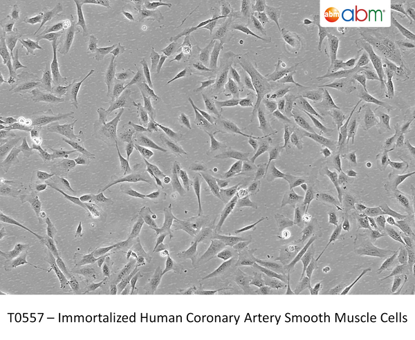 Immortalized Human Coronary Artery Smooth Muscle Cells | Applied Biological Materials (abm)