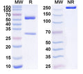 SDS-PAGE for Anti-Human CD31/PECAM1 Antibody (SAA1541)