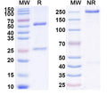 Anti-Human Siglec-2/CD22 Reference Antibody (Pinatuzumab) – Figure 1 of 1