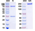 Anti-Human CD22 Reference Antibody (M971) – Figure 1 of 3