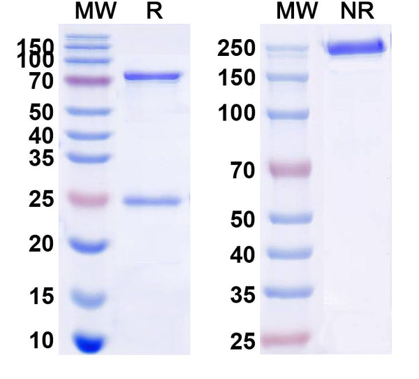 Anti-Human CD22 Reference Antibody (M971) – Figure 1 of 3