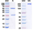 Anti-Human CD22 Reference Antibody (hRFB4) – Figure 1 of 1