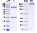 Anti-Human Siglec-2/CD22 Reference Antibody (Epratuzumab, Fc-silenced IgG1k) – Figure 1 of 1