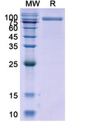 Recombinant Human CD26/DPP4 Protein, C-His