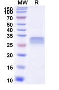 Recombinant Human CD26/DPP4 Protein, N-His