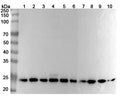 Western blot analysis was performed using anti-PSMB1 polyclonal antibody at 1μg/ml on various samples.
Lane 1: Hela cell lysate
Lane 2: HepG2 cell lysate
Lane 3: MCF-7 cell lysate
Lane 4: K562 cell lysate
Lane 5: THP-1 cell lysate
Lane 6: U937 cell lysate
Lane 7: Mouse spleen lysate
Lane 8: Mouse liver lysate
Lane 9: Rat spleen lysate
Lane 10: Rat liver lysate