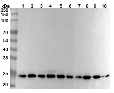Western blot analysis was performed using anti-PSMB1 polyclonal antibody at 1μg/ml on various samples.
Lane 1: Hela cell lysate
Lane 2: HepG2 cell lysate
Lane 3: MCF-7 cell lysate
Lane 4: K562 cell lysate
Lane 5: THP-1 cell lysate
Lane 6: U937 cell lysate
Lane 7: Mouse spleen lysate
Lane 8: Mouse liver lysate
Lane 9: Rat spleen lysate
Lane 10: Rat liver lysate