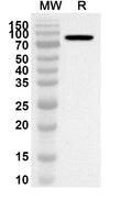 Western blot analysis was performed using anti-MSN polyclonal antibody at 1ug/mL on recombinant MSN (Catalog No. HB033022).