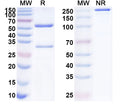 SDS-PAGE for Anti-Human ATF7 Antibody (SAA2118)