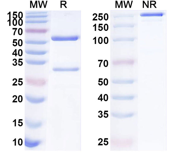 SDS-PAGE for Anti-Human ATF7 Antibody (SAA2118)