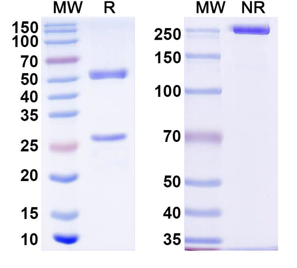 SDS-PAGE for Anti-Human ATF7 Antibody (SAA2119)