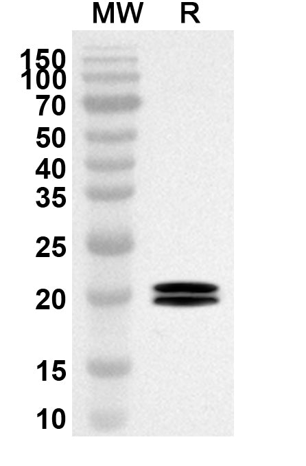 Western blot analysis was performed using anti-Human CD88/C5AR1 polyclonal antibody at 1ug/mL on recombinant Human CD88/C5AR1 (Catalog No. HB064012).