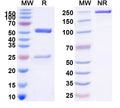 Anti-Human CD120b/TNFRSF1B/TNFR2 Reference Antibody (BI-1910, IgG1) – Figure 1 of 1