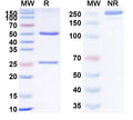 Anti-Human CD120b/TNFRSF1B/TNFR2 Reference Antibody (BI-1808) – Figure 1 of 1