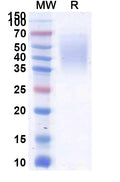 Recombinant Human CD58/LFA3 Protein, C-His