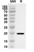 Western blot analysis was performed using anti-ZNF18 polyclonal antibody at 1ug/mL on recombinant ZNF18 (Catalog No. HB084012).