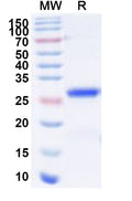 Recombinant Human LAMA1 Protein, N-His