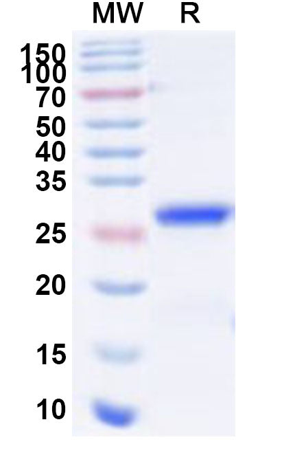 Recombinant Human LAMA1 Protein, N-His