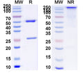 SDS-PAGE for Anti-Mouse/Rat DRD2 Antibody (SAA0784)