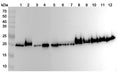 Western blot analysis was performed using anti-PEBP1 polyclonal antibody at 1ug/mL on various samples.
Lane 1: N2A cell lysate
Lane 2: PC-12 cell lysate
Lane 3: A549 cell lysate
Lane 5: 293T cell lysate
Lane 7: MCF-7 cell  lysate
Lane 8: Mouse brain lysate
Lane 9: Mouse liver lysate
Lane 10: Mouse testis lysate
Lane11: Rat liver lysate
Lane12: Rat testis lysate