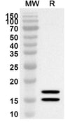 Western blot analysis was performed using anti-AREG polyclonal antibody at 1ug/mL on recombinant AREG (Catalog No. HB092012).