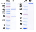 SDS-PAGE for Anti-Alpha-2C adrenergic receptor Antibody (N330A/51)
