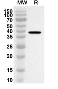 Western blot analysis was performed using anti-Human ADRA2C polyclonal antibody at 1ug/mL on recombinant Human ADRA2C (Catalog No. HB097012).