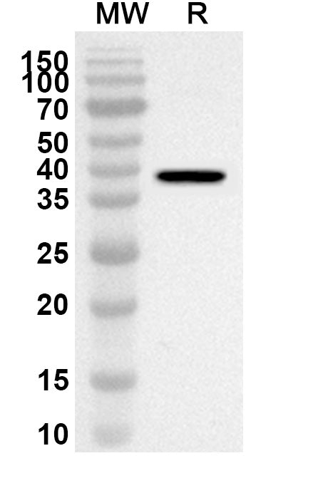 Western blot analysis was performed using anti-Human ADRA2C polyclonal antibody at 1ug/mL on recombinant Human ADRA2C (Catalog No. HB097012).