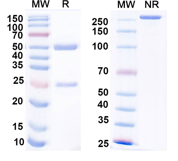 SDS-PAGE for Anti-Mouse/Rat Parvalbumin Antibody (L114/3)