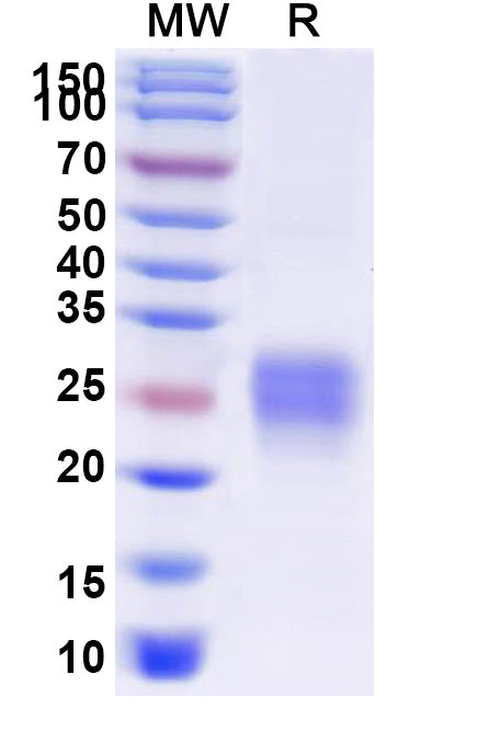 Recombinant Human CD32b/FCGR2B Protein, C-His