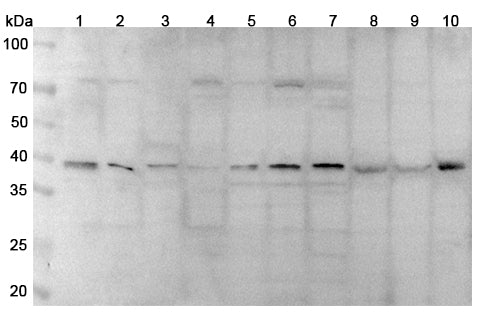 Western blot analysis was performed using anti-CD326 polyclonal antibody at 1μg/ml on various samples.
Lane 1: U937 cell lysate
Lane 2: Daudi cell lysate
Lane 3: Raji cell lysate
Lane 4: RAW264.7 cell lysate
Lane 5: K562 cell lysate
Lane 6: 293T cell lysate
Lane 7: Rat colon lysate
Lane 8: Rat liver lysate
Lane 9: Rat lung lysate