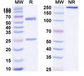 Anti-Human CD32b/FCGR2B Reference Antibody (SM201) – Figure 1 of 1