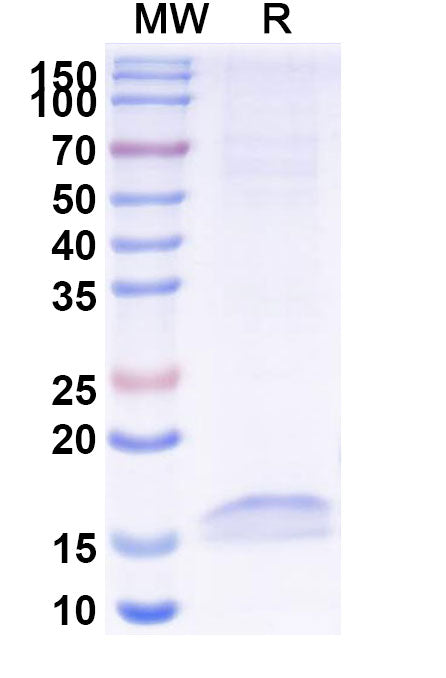 SDS-PAGE for Anti-Human CD326/EPCAM Nanobody (SAA1341)