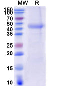 Recombinant Human CD116/CSF2RA Protein, C-His
