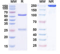 Anti-Human GM-CSF R alpha Reference Antibody (Mavrilimumab) – Figure 1 of 1