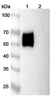 SEC-HPLC detection for Anti-Human CD116/CSF2RA Antibody (CAM-3001).