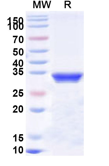 Recombinant Human ITGA3/CD49c Protein, N-His