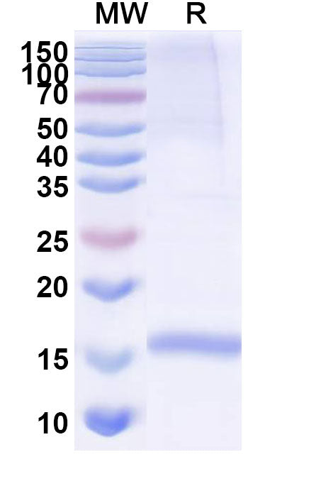 SDS-PAGE for Anti-Human CD49c/ITGA3 Nanobody (SAA1303).