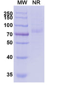 Recombinant Human ERBB3/HER3 Protein, C-His