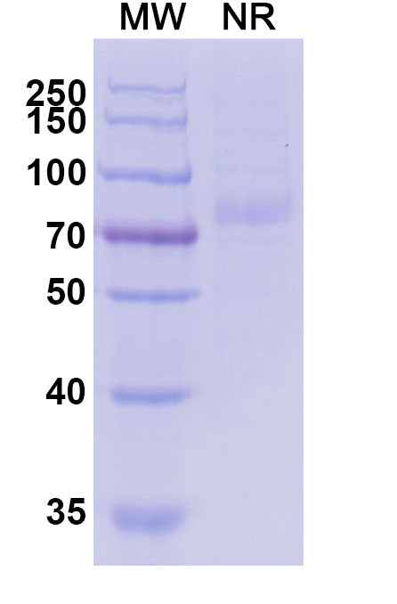 Recombinant Human ERBB3/HER3 Protein, C-His